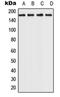 Rho Associated Coiled-Coil Containing Protein Kinase 2 antibody, orb214903, Biorbyt, Western Blot image 