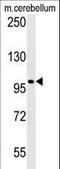 Enhancer Of Polycomb Homolog 2 antibody, LS-C167784, Lifespan Biosciences, Western Blot image 