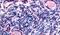 Ribitol Xylosyltransferase 1 antibody, PA5-33083, Invitrogen Antibodies, Immunohistochemistry frozen image 