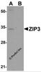 Solute Carrier Family 39 Member 3 antibody, 6085, ProSci, Western Blot image 