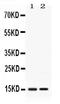 Apolipoprotein C3 antibody, PB10043, Boster Biological Technology, Western Blot image 