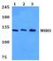 MutS Homolog 3 antibody, PA5-75306, Invitrogen Antibodies, Western Blot image 