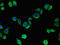 Matrix Metallopeptidase 13 antibody, LS-C318143, Lifespan Biosciences, Immunofluorescence image 