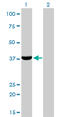 Aldo-Keto Reductase Family 1 Member C4 antibody, LS-B5390, Lifespan Biosciences, Western Blot image 