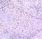 Janus Kinase 2 antibody, NBP2-67429, Novus Biologicals, Immunohistochemistry paraffin image 