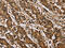 Proteasome 26S Subunit, ATPase 2 antibody, CSB-PA134529, Cusabio, Immunohistochemistry paraffin image 