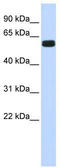 HIC ZBTB Transcriptional Repressor 2 antibody, TA331967, Origene, Western Blot image 