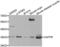 Ciliary Neurotrophic Factor Receptor antibody, abx002062, Abbexa, Western Blot image 