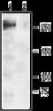 Sodium Voltage-Gated Channel Alpha Subunit 1 antibody, GTX54841, GeneTex, Western Blot image 