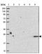 Proteasome subunit beta type-9 antibody, NBP2-33681, Novus Biologicals, Western Blot image 