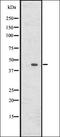 Olfactory Receptor Family 52 Subfamily K Member 2 antibody, orb336470, Biorbyt, Western Blot image 