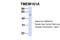 Transmembrane Protein 161A antibody, PA5-43020, Invitrogen Antibodies, Western Blot image 