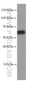 Sequestosome 1 antibody, 66184-1-Ig, Proteintech Group, Western Blot image 