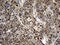 Glycerol-3-Phosphate Acyltransferase 3 antibody, LS-C792216, Lifespan Biosciences, Immunohistochemistry paraffin image 