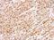 BRCA1 Interacting Protein C-Terminal Helicase 1 antibody, PA5-27096, Invitrogen Antibodies, Immunohistochemistry frozen image 