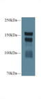 Thrombospondin 1 antibody, LS-C372561, Lifespan Biosciences, Western Blot image 