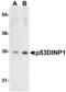 Tumor Protein P53 Inducible Nuclear Protein 1 antibody, 56223, QED Bioscience, Western Blot image 