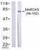 Myristoylated alanine-rich C-kinase substrate antibody, AP02758PU-S, Origene, Western Blot image 