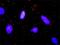 SL cytokine antibody, H00002323-M07, Novus Biologicals, Proximity Ligation Assay image 