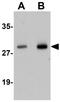 Synaptogyrin 2 antibody, GTX17057, GeneTex, Western Blot image 