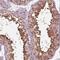 RuvB Like AAA ATPase 2 antibody, NBP2-57593, Novus Biologicals, Immunohistochemistry paraffin image 