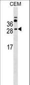 Membrane Spanning 4-Domains A3 antibody, LS-B12866, Lifespan Biosciences, Western Blot image 