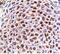 TNF Receptor Superfamily Member 11a antibody, AF692, R&D Systems, Immunohistochemistry paraffin image 