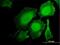 Hematopoietic Cell-Specific Lyn Substrate 1 antibody, H00003059-M06, Novus Biologicals, Immunofluorescence image 