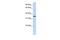 Ankyrin Repeat Domain 9 antibody, GTX45678, GeneTex, Western Blot image 