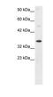 General Transcription Factor IIH Subunit 3 antibody, PA1-24392, Invitrogen Antibodies, Western Blot image 