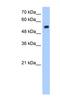 Zinc Finger Protein Interacting With K Protein 1 antibody, NBP1-79356, Novus Biologicals, Western Blot image 