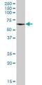 CPN3 antibody, H00008895-B01P, Novus Biologicals, Western Blot image 