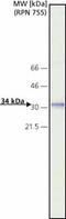 Cathepsin D antibody, ab6313, Abcam, Western Blot image 