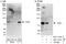 Formin Binding Protein 1 antibody, NBP1-47260, Novus Biologicals, Western Blot image 