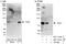 Formin-binding protein 1 antibody, NBP1-47260, Novus Biologicals, Western Blot image 