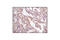 ERBB2 antibody, 2165S, Cell Signaling Technology, Immunohistochemistry frozen image 