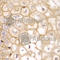 Major Histocompatibility Complex, Class I, A antibody, A2167, ABclonal Technology, Immunohistochemistry paraffin image 