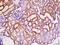 TNF Receptor Superfamily Member 13B antibody, GTX51554, GeneTex, Immunohistochemistry paraffin image 