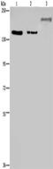 Lysine Demethylase 3B antibody, CSB-PA052445, Cusabio, Western Blot image 