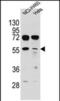 TSPY Like 6 antibody, PA5-71512, Invitrogen Antibodies, Western Blot image 