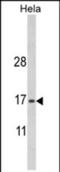 Mitochondrial Inner Membrane Protein MPV17 antibody, PA5-72567, Invitrogen Antibodies, Western Blot image 