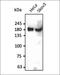 Insulin Receptor antibody, orb379724, Biorbyt, Western Blot image 