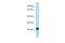 Crystallin Gamma A antibody, A13536, Boster Biological Technology, Western Blot image 