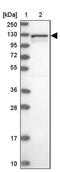 Rho guanine nucleotide exchange factor 18 antibody, PA5-60083, Invitrogen Antibodies, Western Blot image 