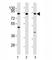 Inhibitor Of Nuclear Factor Kappa B Kinase Subunit Beta antibody, F40420-0.4ML, NSJ Bioreagents, Western Blot image 