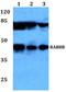 RAB8B, Member RAS Oncogene Family antibody, A06646, Boster Biological Technology, Western Blot image 