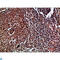 Cyclin Dependent Kinase 6 antibody, LS-C813815, Lifespan Biosciences, Immunohistochemistry paraffin image 