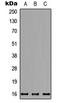 NADH:Ubiquinone Oxidoreductase Subunit B7 antibody, LS-C354435, Lifespan Biosciences, Western Blot image 