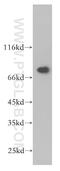 Ecdysoneless Cell Cycle Regulator antibody, 10192-1-AP, Proteintech Group, Western Blot image 