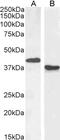 Paired Box 5 antibody, 45-105, ProSci, Western Blot image 